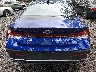KMHLM4DG4RU****** Destrozados 2024 Hyundai Elantra
