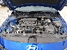 KMHLS4DG8SU****** Repairable 2025 Hyundai Elantra in Chicago South