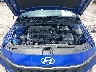 KMHLM4DGXTU****** Repairable 2026 Hyundai Elantra in Dallas