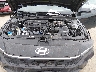 KMHLL4DG0SU****** Repairable 2025 Hyundai Elantra in Fort Worth North