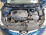 KMHDH4AE9FU****** Repairable 2015 Hyundai Elantra in Fargo