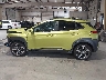 KM8K53A53LU****** Salvage 2020 Hyundai Kona