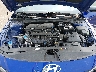 KMHLM4DG7SU****** Repairable 2025 Hyundai Elantra in Nashville